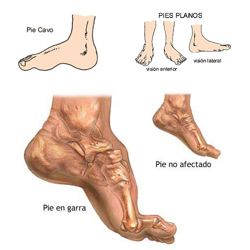 pie plano